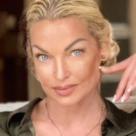 "Морили голодом!": Волочкова отдала миллионы за неудачную операцию в "худшей клинике Германии"