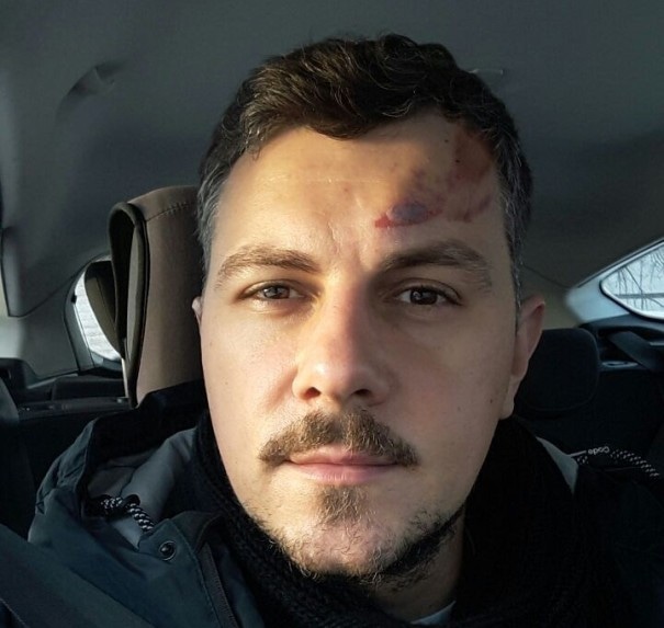 Алексей Секирин после ДТП Алексей Секирин после ДТП