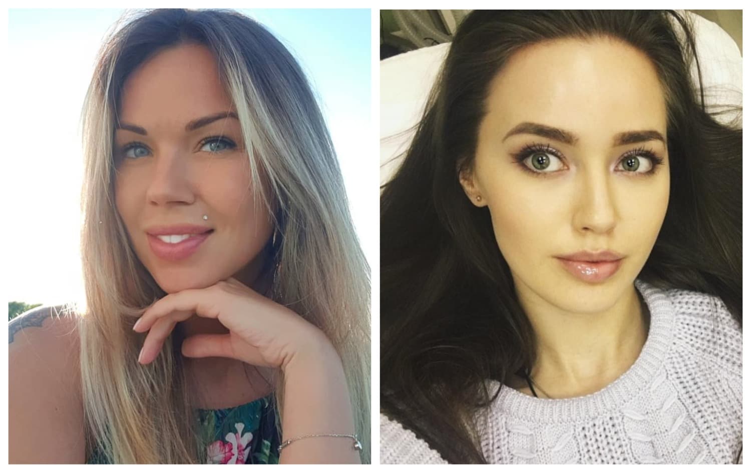 Анастасия Костенко фото до и после пластики