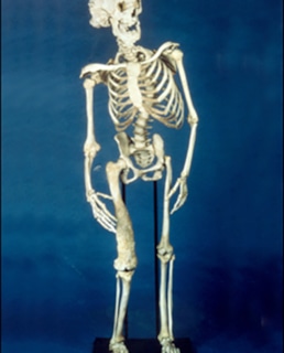 Скелет Джозефа Меррика