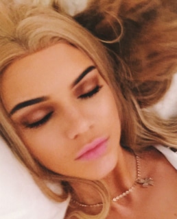 Кендалл Дженнер накачала губы