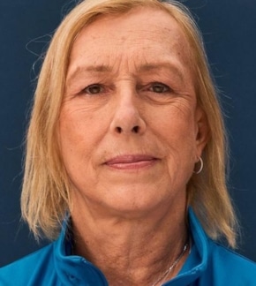 фотография Мартина Навратилова