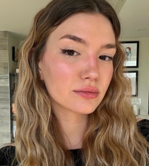 фотография Алиса Сковбай