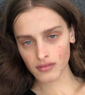 фотография Адица Берзения