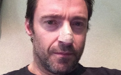 У Хью Джекмана обнаружили рак кожи