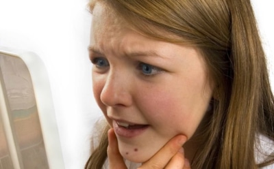 Как избавиться от угрей