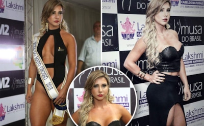 Топ-модель Ракель Сантос скончалась после пластической операции