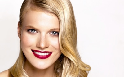 Голливудская улыбка при помощи виниров