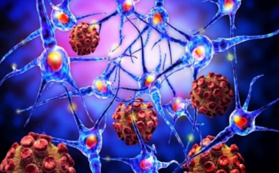 Ученые из России создали революционные наночастицы, убивающие рак