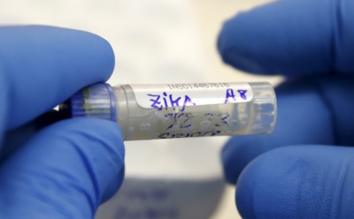 В России зафиксирован новый случай заражения вирусом Зика