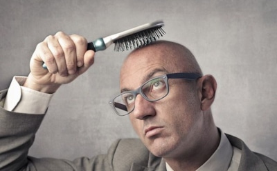 "Мужское облысение": раскрыта истинная причина выпадения волос у мужчин
