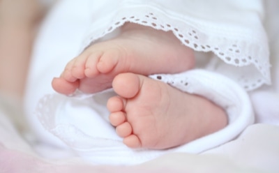 В Индии родилась девочка с двумя головами и тремя руками