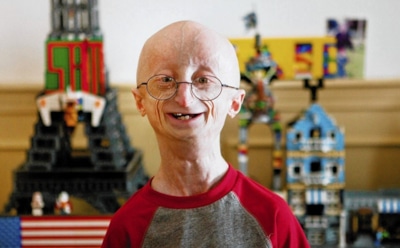 10 самых необычных заболеваний в мире