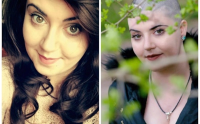 В США врачи 10 лет не могли установить девушке рак головного мозга