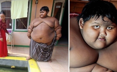 Самый тяжелый в мире ребенок сбросил за месяц 31 кг