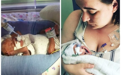 В Британии медики спасли младенца, рожденного с весом 600 г