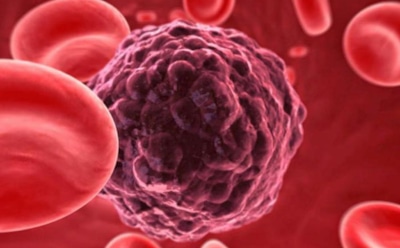 Опухоль «знает», чем ее собираются лечить – ученые