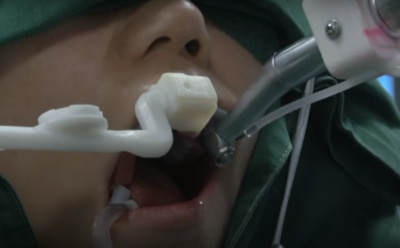 В Китае робот-дантист вставил человеку 3D-печатные зубы