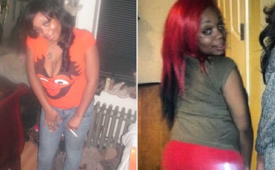 Поклонница Ким Кардашьян умерла после увеличения ягодиц