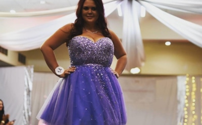 В Австралии 23-летняя мать страдает от огромного размера груди