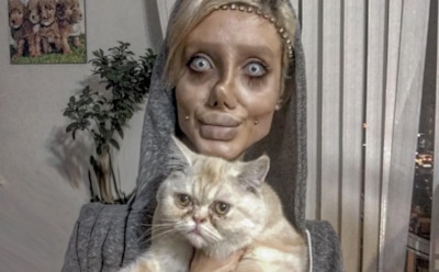 Иранка сделала 50 операций, чтобы быть похожей на Джоли, но в итоге стала «трупом»