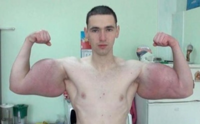 СМИ: «синтоловый качок» попал в больницу и лишился «самого дорогого»