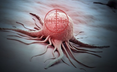 Ученые из России уничтожили рак, заставив клетки «голодать»