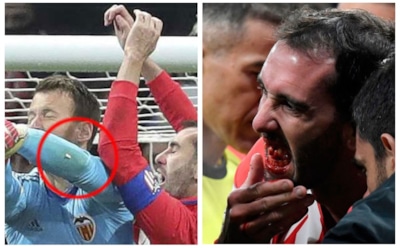 Капитан «Атлетико» в борьбе за мяч лишился зубов