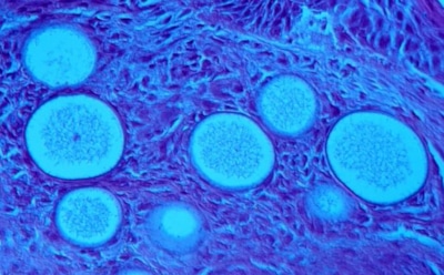 Жительница США обнаружила в сушилке для рук патогенные грибы