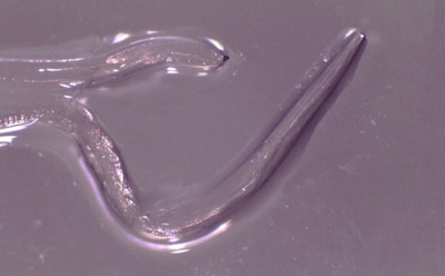 В США в глазу женщины обнаружили 14 редких червей