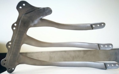 В Британии мужчине имплантировали грудную клетку из 3D-принтера