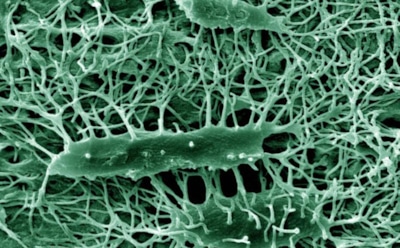 Ученые рассказали о причине хрупкости костей ВИЧ-инфицированных