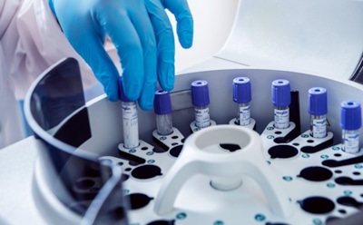 В России создали клетки для борьбы с сахарным диабетом