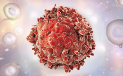 Ученые из США выявили причину развития особо агрессивного рака