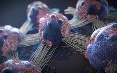 Установлена причина образования рака молочной железы