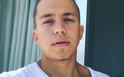 Звезда «Кухни» Сергей Романович пересадил волосы с затылка на лицо