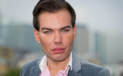 «Живой Кен» после 64 операций жалеет о неудачной пластике