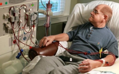 Ученые создали искусственные вены для пациентов на диализе