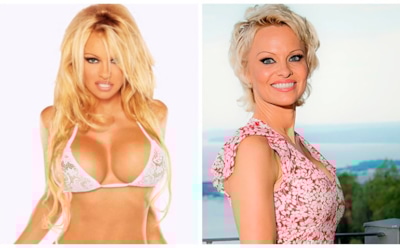 7 знаменитостей, уменьшивших грудь