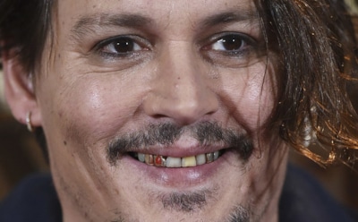 7 самых "неголливудских" улыбок знаменитостей