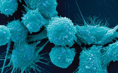 Ученые: объем мышц позволит женщинам победить рак груди