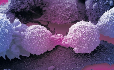 Исследователи назвали причины распространения заразного рака