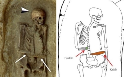 Археологи нашли  на раскопках в Италии первого «киборга»