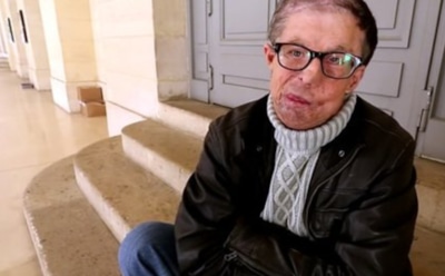 Во Франции мужчине пересадили третье лицо