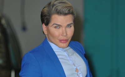 «Живой Кен» рассказал о сильных болях после удаления ребер