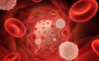 Онкологи перечислили 10 признаков лейкемии