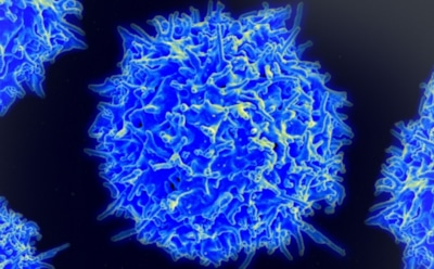 Ученые из США объяснили механизм появления неизлечимого рака