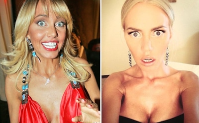 8 знаменитостей, уменьшивших губы