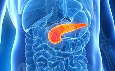 Названы 3 начальных симптома рака поджелудочной железы