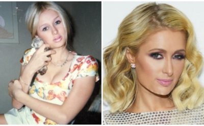 7 звезд, сделавших неудачную блефаропластику